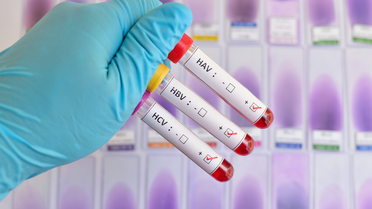 National gov’t urged to boost hepatitis funding to prevent liver cancer