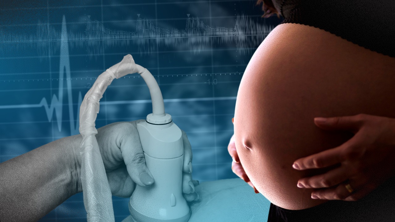 PH maternal mortality declines, but still short of SDG target