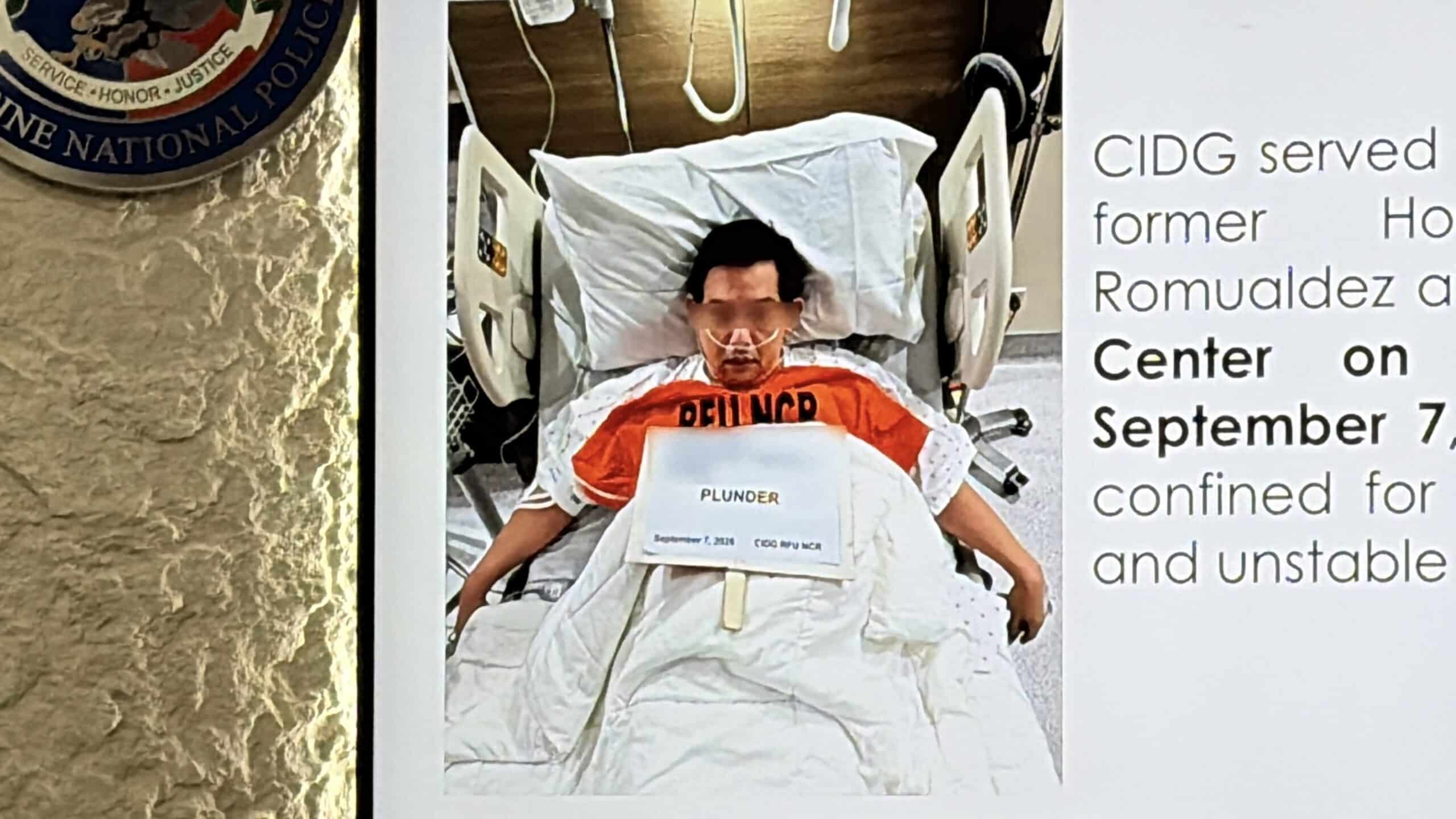 LOOK: DILG releases mugshot of hospitalized Romualdez