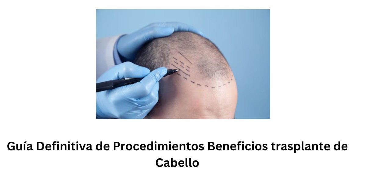 Guía Definitiva de Procedimientos & Beneficios trasplante de Cabello